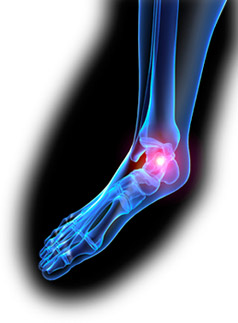Foot pain
